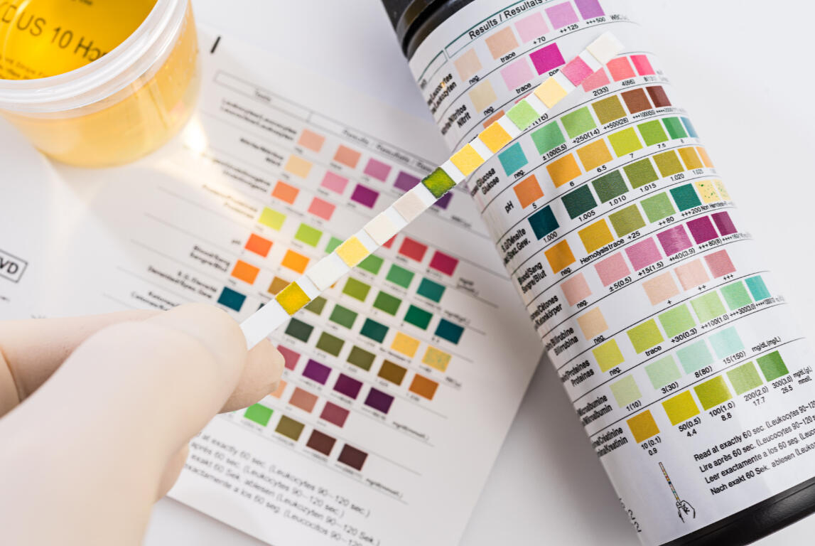 Verifying vaccination passport